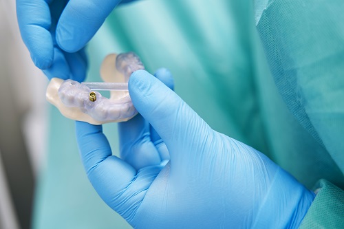 Equipement pour implantologie dentaire