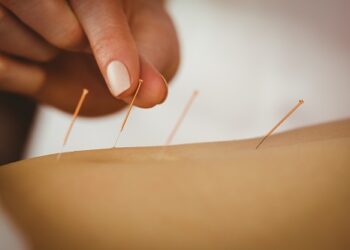 acupuncture à Nice